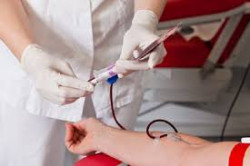 Autohemodonaci&oacute;n
