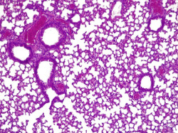 Crean una `p&iacute;ldora viva` para combatir infecciones pulmonares resistentes a antibi&oacute;ticos