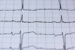 Desarrollan unos parches electr&oacute;nicos ultrafinos que pueden controlar el pulso y la presi&oacute;n arterial del usuario