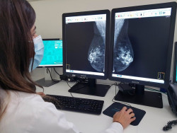 Detecci&oacute;n basada en la densidad mamaria a los 40 a&ntilde;os, eficaz y rentable para reducir la mortalidad por c&aacute;ncer de mama