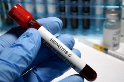 El cribado de la hepatitis C se duplica cuando se piden las pruebas con antelaci&oacute;n