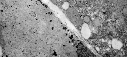 El ISCIII documenta los primeros casos en Espa&ntilde;a de un enterovirus raro ligado a enfermedad respiratoria y neurol&oacute;gica