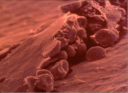 El rico colesterol, por el Dr  D. Jos&eacute; Manuel Revuelta