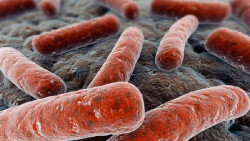 Infecciones repetidas se asocian a mayor riesgo de enfermedades neurodegenerativas