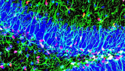 Investigadoras del CSIC descubren un nuevo mecanismo para activar las c&eacute;lulas madre del cerebro adulto