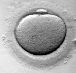 La competencia entre las hembras humanas probablemente contribuy&oacute; a que la ovulaci&oacute;n en las mujeres sea oculta