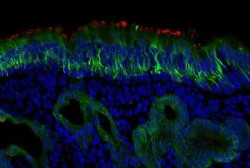 Las c&eacute;lulas de la nariz son el punto de entrada clave del virus Covid-19