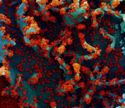 Las c&eacute;lulas T de los resfriados comunes protegen contra la infecci&oacute;n por SARS-CoV-2, seg&uacute;n estudio