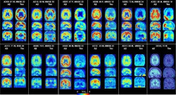 Los investigadores crean un `mapa de Google` molecular del cerebro
