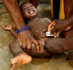 Mutilaci&oacute;n genital en Espa&ntilde;a