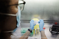 Sanidad confirma 233 casos positivos de viruela del mono y otros 462 sospechosos en Espa&ntilde;a