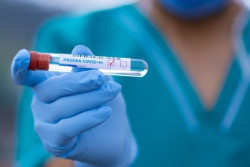  Sanidad y CCAA aprueban la nueva vigilancia de la COVID-19, que centra las pruebas en vulnerables y graves