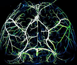 Un gran estudio revela pocas diferencias entre los cerebros de hombres y mujeres